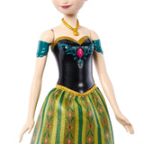 Frozen Anna Musical